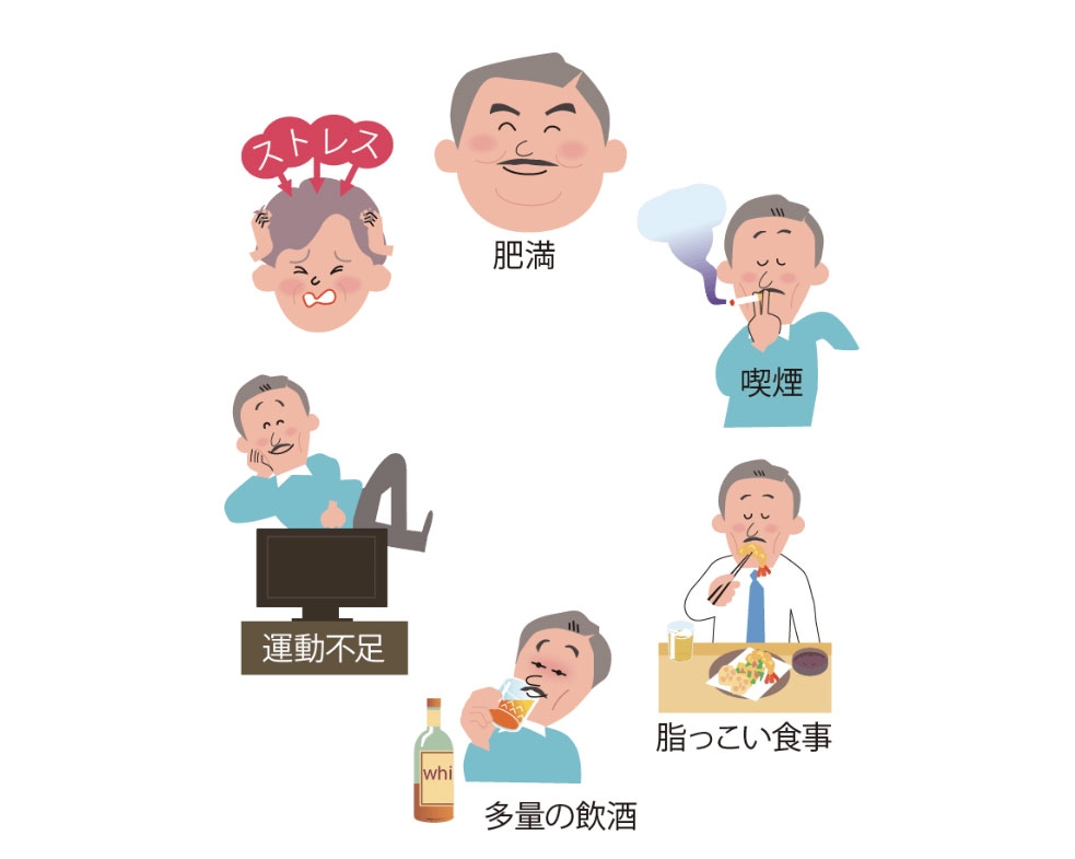肥満 喫煙 油っぽい食事 多量の飲酒 運動不足 ストレス