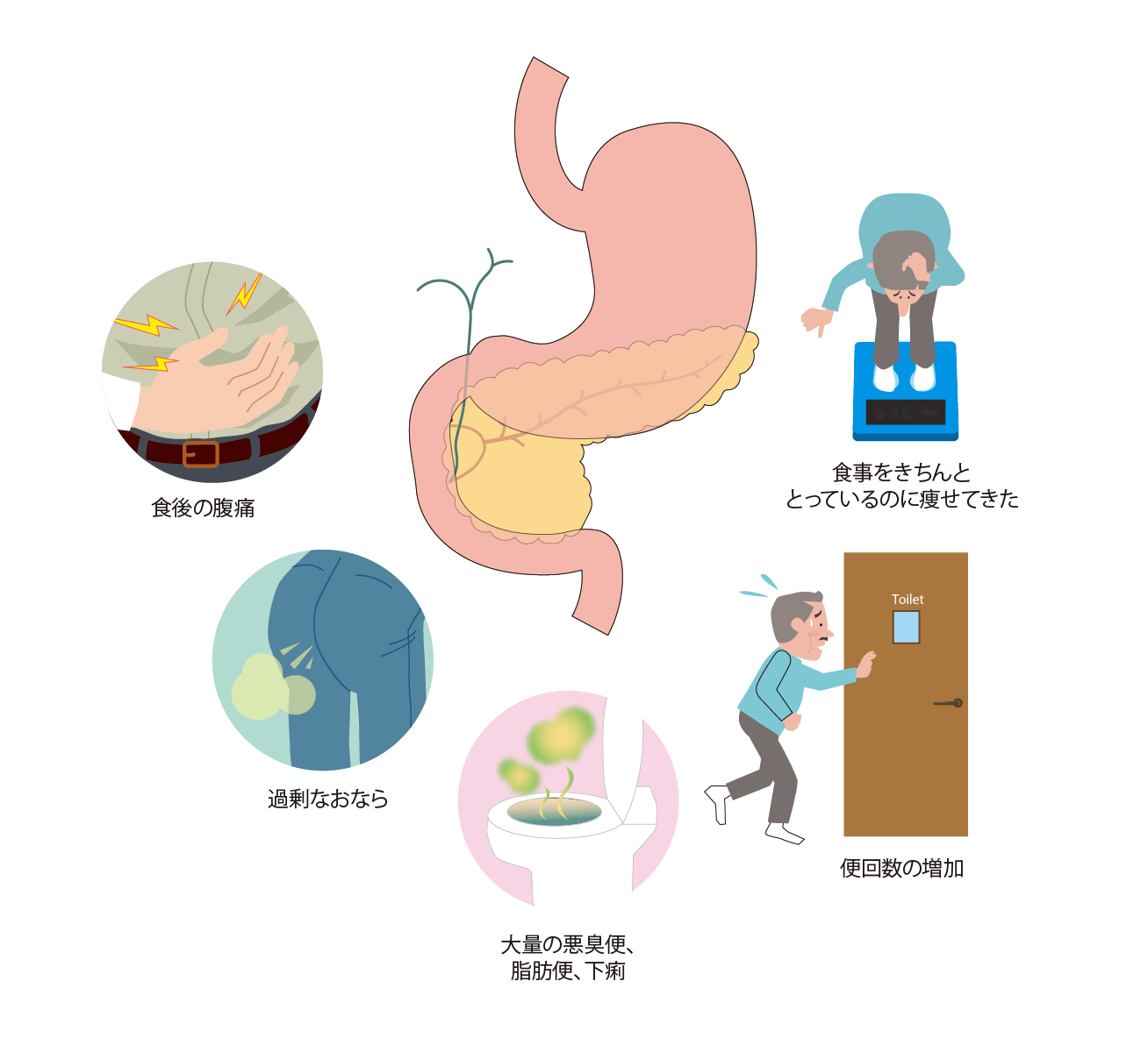 膵外分泌機能不全の症状